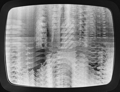 Photovision