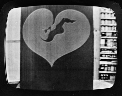 Photovision
